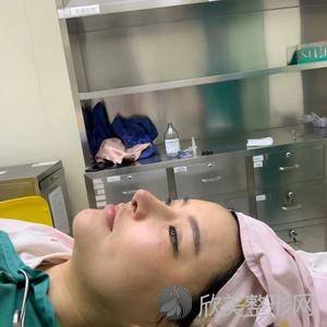 大庆哪家医院做假体隆鼻修复效果好？排名前四权威医美口碑盘点-含手术价格