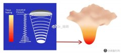 半岛超声炮按优势效果-超全攻略来咯