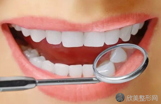 牙齿矫正一般有哪几种方式
