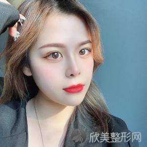 亳州哪家医院做鼻综合整形手术好？2020-还有整鼻综合整形价格案例参考哦!！