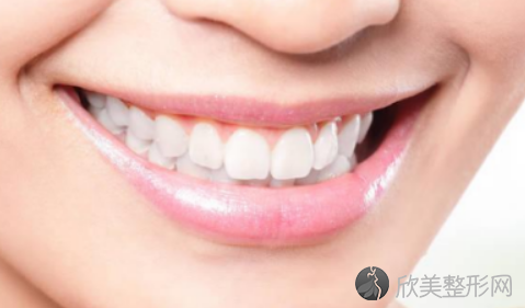 35岁矫正牙齿对牙齿都有些什么伤害