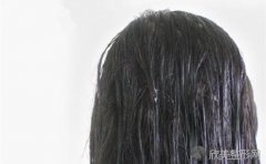 勤洗头，为何头发还是易出油？易出油的原因都有什么？