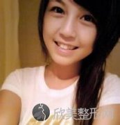 洗牙应慎重几种情况