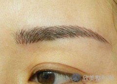 大家在哈尔滨种植过眉毛吗，费用大概在什么范围？