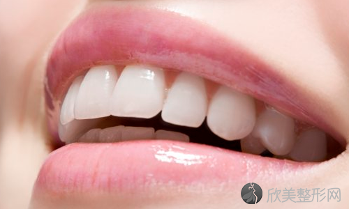牙齿美白矫正的几种常见方法