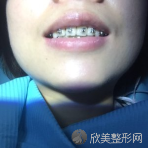 终于知道漯河牙科医院哪几家比较好了,也分享给大家