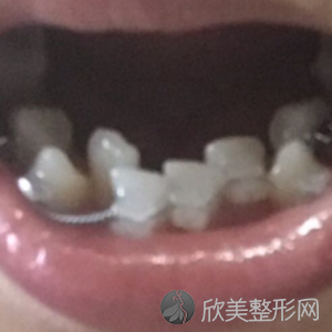 扬州城阳牙科诊所的排名及地址已更新,推荐的是正规的口腔