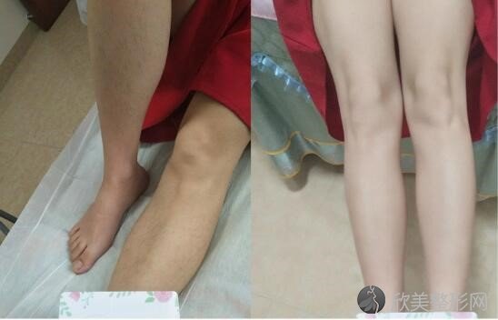 贵阳莲姿娜韩式半美容中心