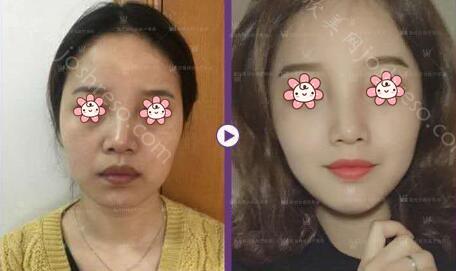 重庆玺悦台整形美容门诊部