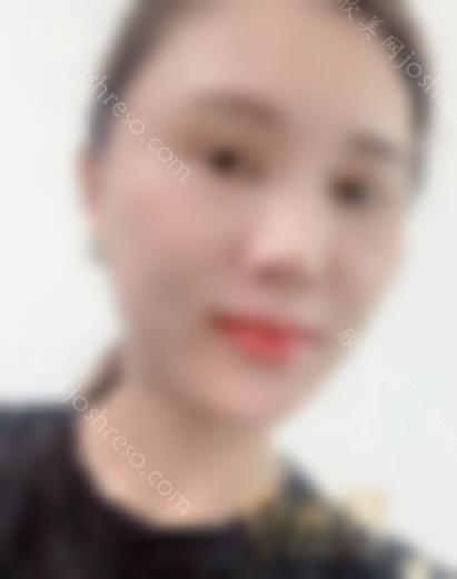 松原哪家整形医院比较好？排行前三参考如下还有专家案例和价格一览