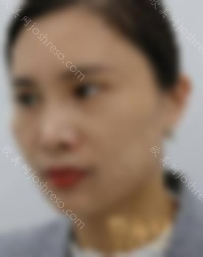 松原哪家整形医院比较好？排行前三参考如下还有专家案例和价格一览