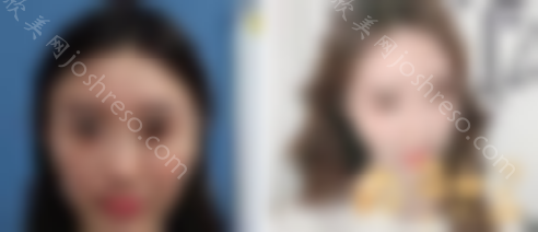 北京悦美好医医疗美容门诊部怎么样？2024年干货价格表全部分享!