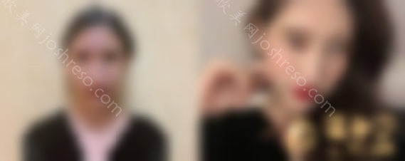成都仪美整形美容医院靠谱吗？2024价格表新版一览~