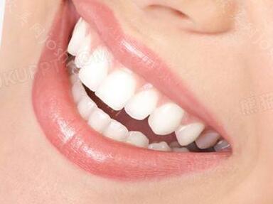烂牙龈图片，如何修复牙齿牙齿的费用多少呢？