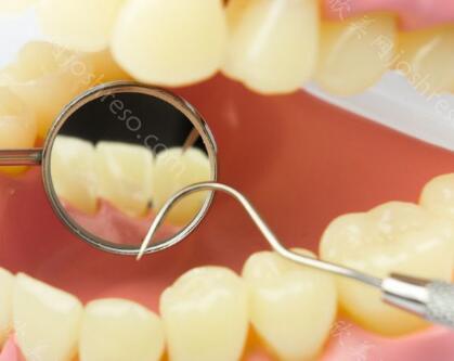 烂牙龈图片，如何修复牙齿牙齿的费用多少呢？