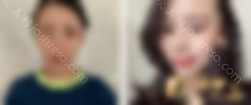 武汉美莱医疗美容医院怎么样？附2024较新价格表及医院简介~