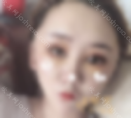 北京常好丽格整形医院如何？2024公布价目表新排版一览~