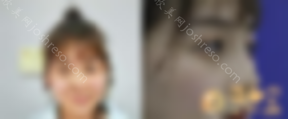 北京沃尔刘彦军医疗美容如何？正版2024价格(价目表)全部上新~