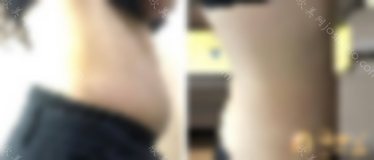 南宁梦想整形美容医院如何？2024整形价格表一览