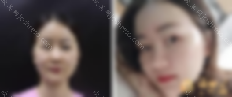 重庆天艺美医疗美容医院如何？专家详情+2024人气价目表~