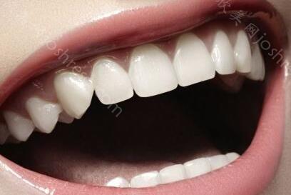 种植牙多少钱一颗2021？种植牙齿的优势有哪些呢？