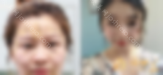 北京知音脂肪整形医院靠谱吗？2024公布价目表新排版一览~