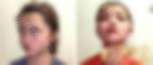 北京西美医疗美容门诊部靠谱吗？价格表价目2024版线上免费看