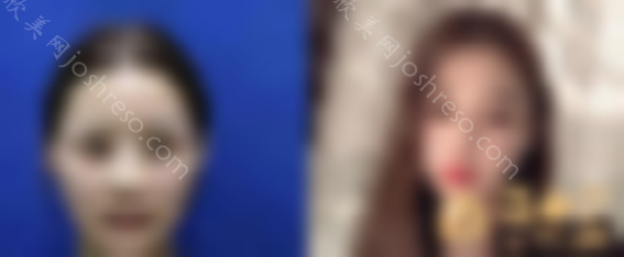 西安美莱整形美容医院怎么样？2024价格表新版一览~