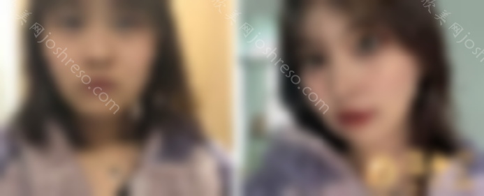 沈阳伊美尔医疗美容医院怎么样？2024整形价格表一览
