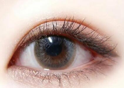 美杜莎双眼皮的特点是什么呢？美杜莎双眼皮多久能够恢复？
