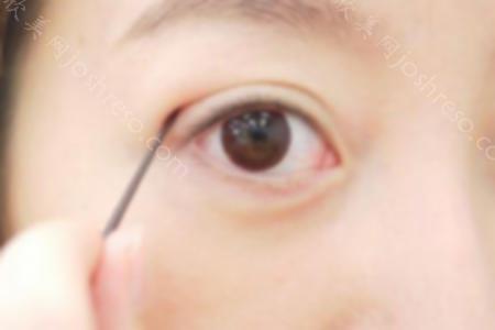 双眼皮手术哪种方法好 双眼皮手术后如何护理？