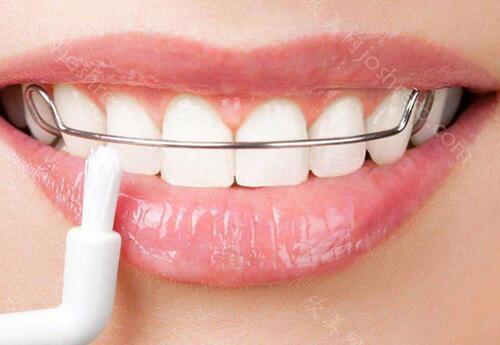 隐形义齿图片什么样呢？和种植牙齿相比哪种更好一些呢？