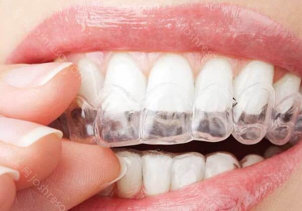 矫正牙齿隐形牙套费用多少呢？矫正牙齿可能会带来哪些危害呢？