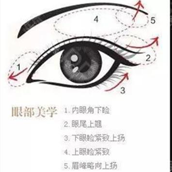 杭州连天美程琳眼综合手术如何?三个月术前术后图_价格表更新