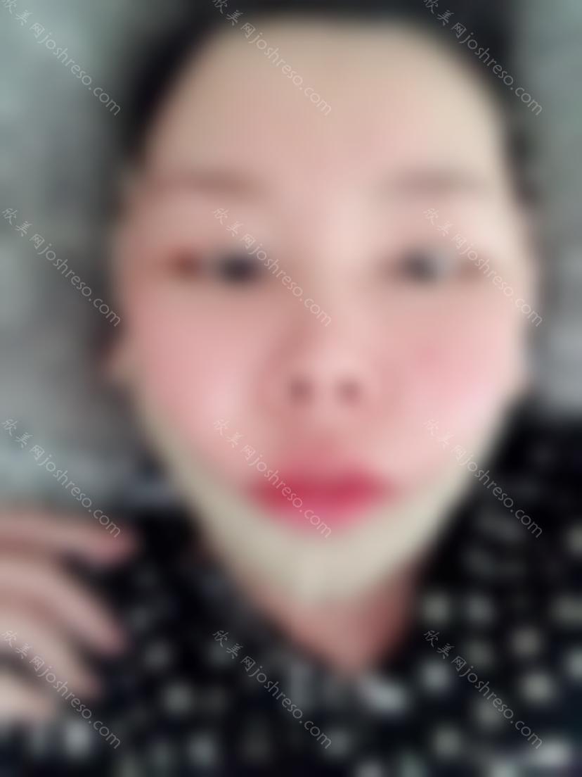 术前照