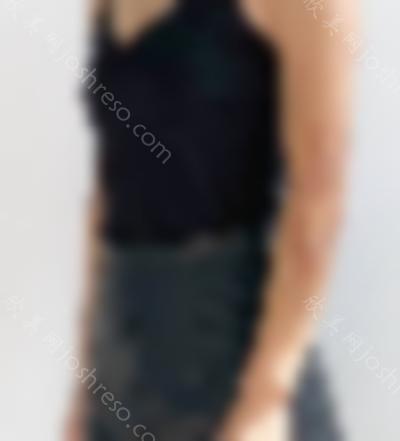 邹普功医生为我做的<a href='https://www.joshreso.com/project/556.html' target='_blank'><u>激光祛疤</u></a>手术前