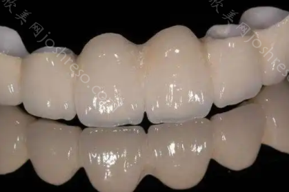 二氧化锆牙齿价格多少钱?二氧化锆瓷牙和全瓷牙有哪些区别?
