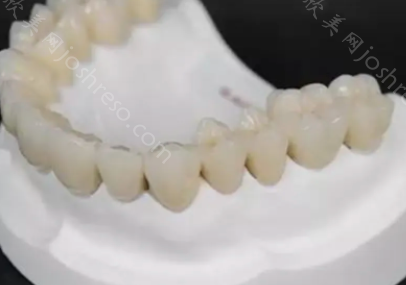 二氧化锆牙齿价格多少钱?二氧化锆瓷牙和全瓷牙有哪些区别?