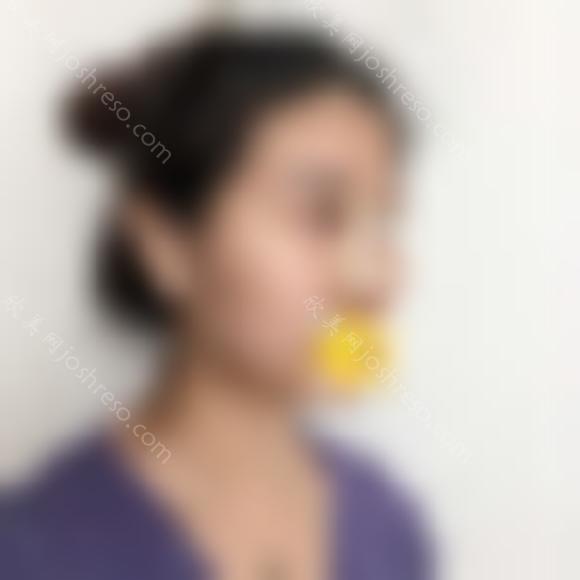 北京协和医院黄渭清鼻子怎么样?顾客反馈案例-收费标准