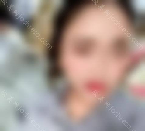 上海九院刘凯的鼻综合做得好吗?案例反馈-收费标准