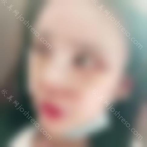 2024上海第九院隆鼻专家介绍及鼻整形价目表一览