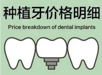 士卓曼种植牙多少钱一颗？士卓曼种植牙有哪些优势？
