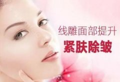 全脸线雕好不好?有没有副作用?全脸线雕多少钱？