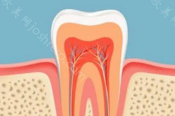 做了根管治疗后牙齿痛怎么办？牙痛治疗期间注意事项有哪些？