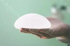 硅胶假体隆胸可以一辈子不取吗？隆胸的假体可以使用多少年？