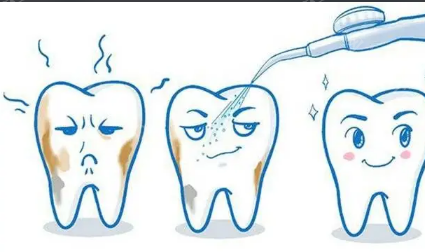 喷砂洗牙适合哪些人群？武汉有没有洗牙效果好的口腔医院推荐？