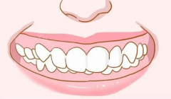 为什么牙齿畸形要及时的去做矫正？成都有没有隐形矫正做得好的口腔？