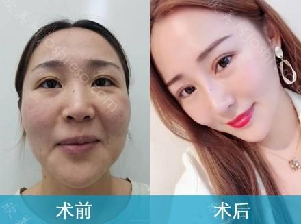 驻马店美兰德医疗整形美容医院美容科价目表-附医院-医生介绍资料~