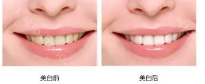 上海市口腔医院牙科收费价目表，包含多种看牙项目，收费不贵