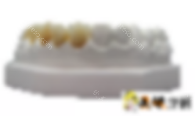 纯钛烤瓷牙的价格之纯钛烤瓷牙简介及特点